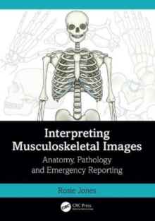 Image for Interpreting musculoskeletal images  : anatomy, pathology and emergency reporting