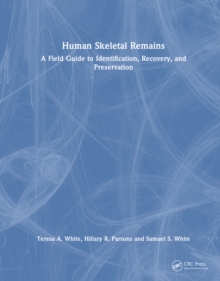 Human Skeletal Remains