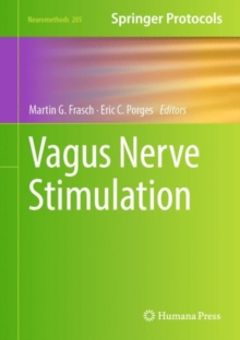 Image for Vagus Nerve Stimulation