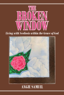 Image for Broken Window: Living With Scoliosis Within the Grace of God