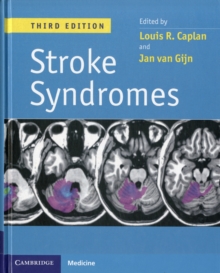 Image for Stroke syndromes
