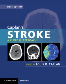 Image for Caplan's stroke : a clinical approach