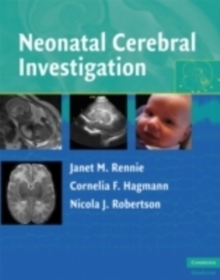 Image for Neonatal cerebral investigation.