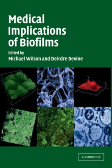 Image for Medical Implications of Biofilms