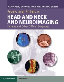 Image for Pearls and Pitfalls in Head and Neck and Neuroimaging: Variants and Other Difficult Diagnoses