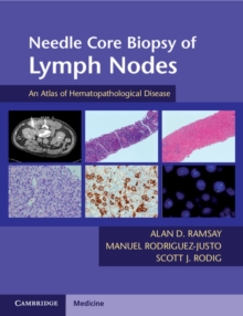 Image for Needle Core Biopsy of Lymph Nodes with DVD-ROM