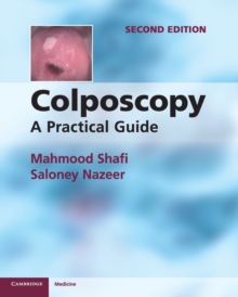 Colposcopy: A Practical Guide