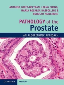 Image for Pathology of the Prostate : An Algorithmic Approach