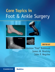 Image for Core Topics in Foot and Ankle Surgery
