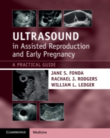 Image for Ultrasound in Assisted Reproduction and Early Pregnancy