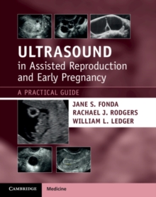 Ultrasound in Assisted Reproduction and Early Pregnancy: A Practical Guide