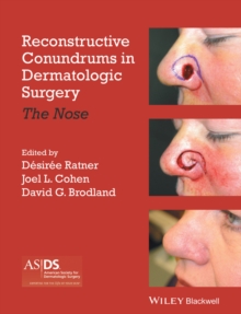 Image for Reconstructive Conundrums in Dermatologic Surgery