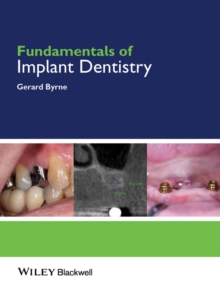 Image for Fundamentals of implant dentistry