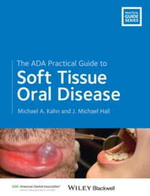 Image for The ADA practical guide to soft tissue oral disease