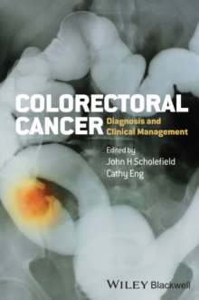 Image for Colorectal Cancer: Diagnosis and Clinical Management