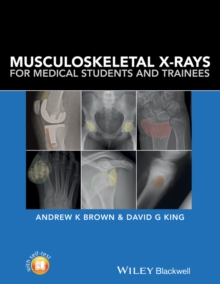 Image for Musculoskeletal X-rays for medical students