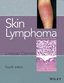 Image for Skin lymphoma: the illustrated guide