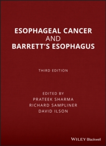 Image for Esophageal Cancer and Barrett's Esophagus