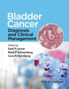 Image for Bladder cancer  : diagnosis and clinical management