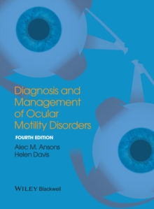 Image for Diagnosis and management of ocular motility disorders