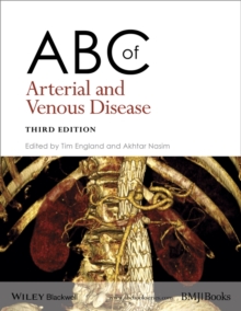Image for ABC of arterial and venous disease.