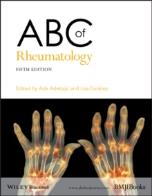 Image for ABC of rheumatology