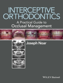 Image for Interceptive orthodontics: a practical guide to occlusal management