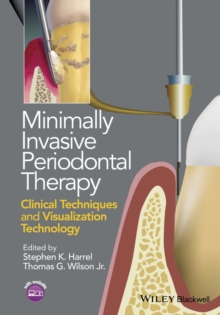 Image for Minimally invasive periodontal therapy: clinical techniques and visualization technology