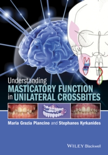 Image for Understanding Masticatory Function in Unilateral Crossbites