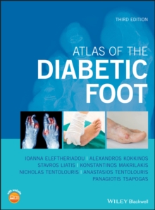 Image for Atlas of the diabetic foot