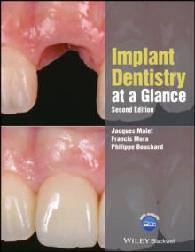 Image for Implant Dentistry at a Glance