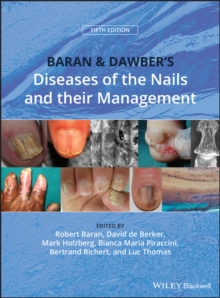 Image for Baran and Dawber's Diseases of the Nails and their Management