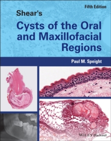 Image for Shear's cysts of the oral and maxillofacial regions