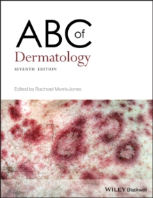 Image for ABC of Dermatology
