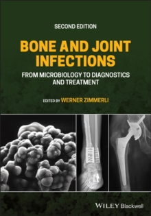 Bone and Joint Infections