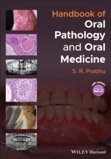 Image for Handbook of oral pathology and oral medicine