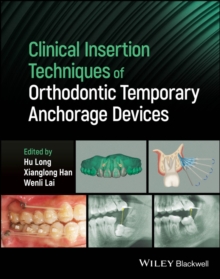 Image for Clinical Insertion Techniques of Orthodontic Tempo rary Anchorage Devices