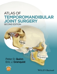 Image for Atlas of temporomandibular joint surgery