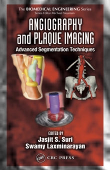 Image for Angiography and plaque imaging: advanced segmentation techniques