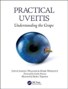 Practical Uveitis: Understanding the Grape