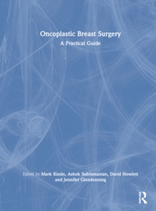 Oncoplastic Breast Surgery: A Practical Guide