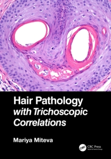 Image for Hair pathology with trichoscopic correlations