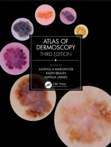 Image for Atlas of Dermoscopy