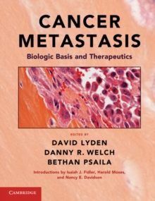 Image for Cancer Metastasis: Biologic Basis and Therapeutics
