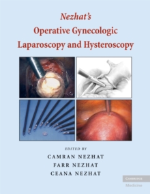 Image for Nezhat's Operative Gynecologic Laparoscopy and Hysteroscopy