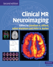 Image for Clinical MR Neuroimaging: Physiological and Functional Techniques