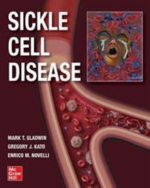 Image for Sickle cell disease