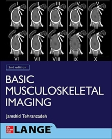 Image for Basic Musculoskeletal Imaging, Second Edition