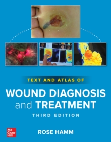Image for Text and Atlas of Wound Diagnosis and Treatment, Third Edition