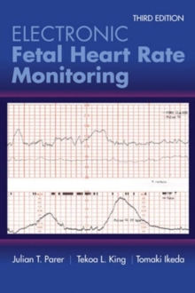 Image for Electronic fetal heart rate monitoring  : the 5-tier system
